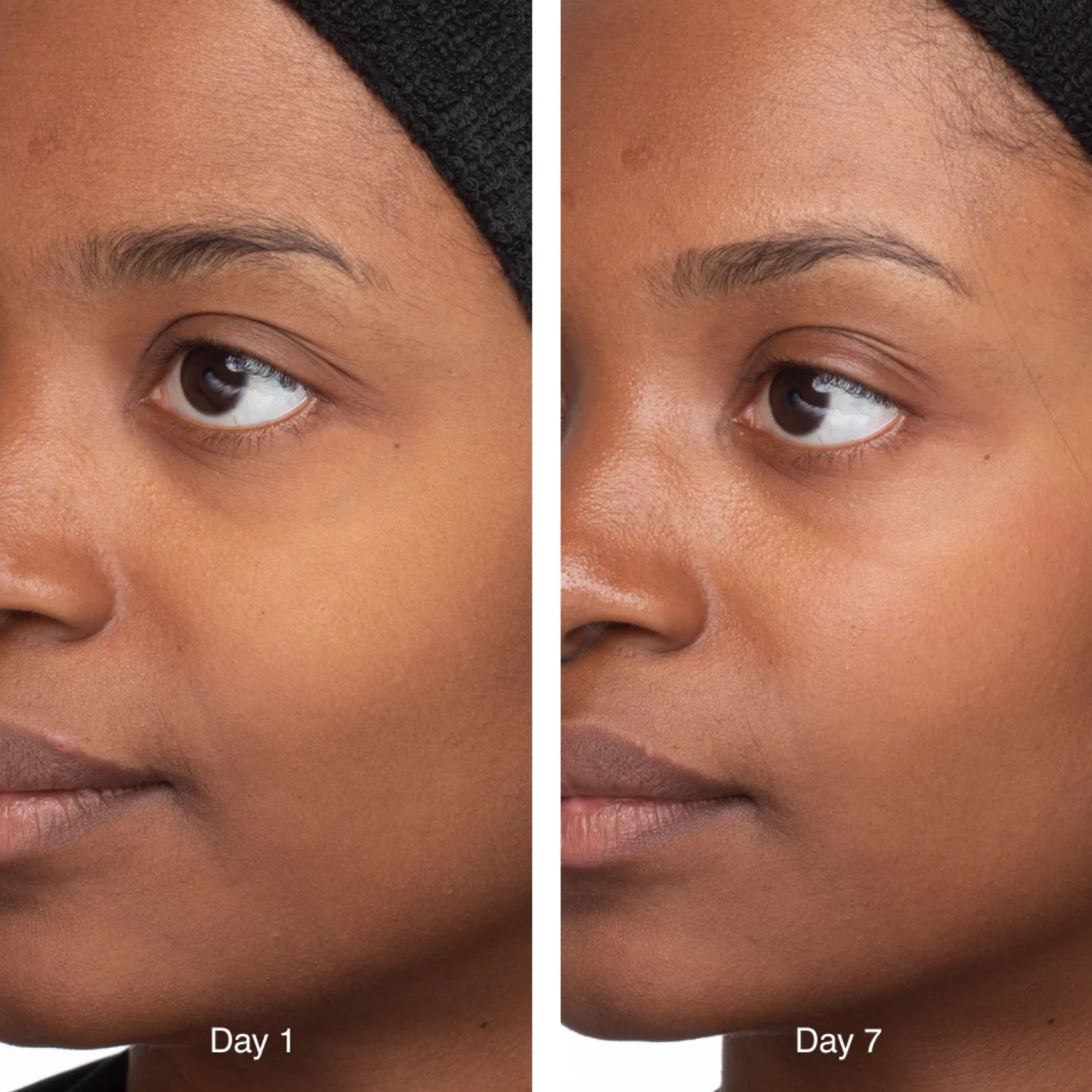Before and after comparison of a woman's face with visible skin texture changes over 7 days.