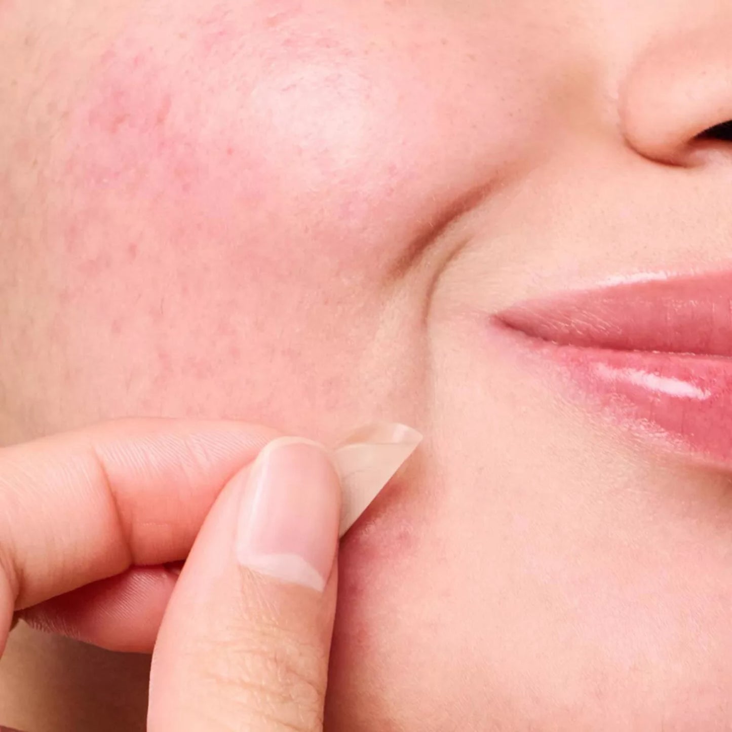 Micropoint for Blemishes