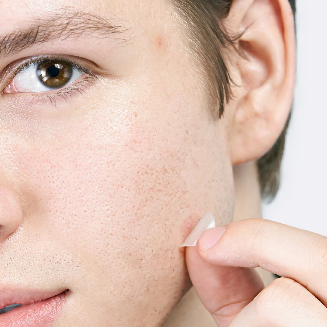Micropoint for Blemishes
