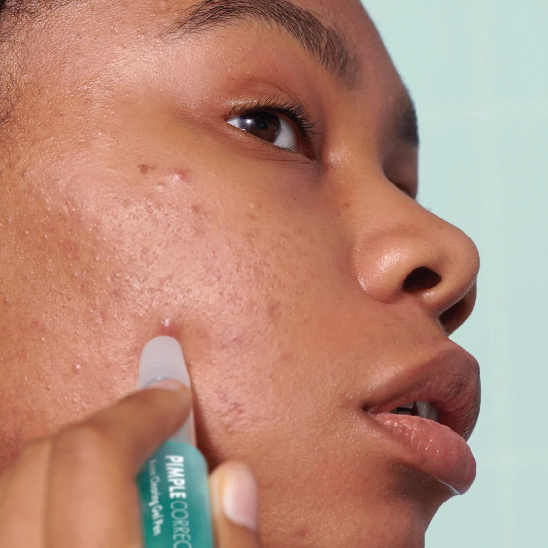Pimple Correct