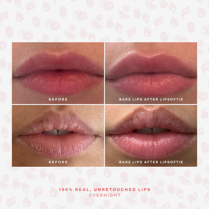 LipSoftie Lip Treatment